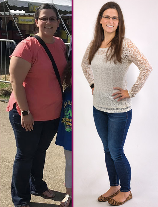 Amie's Story, Bariatric Weight Loss Success