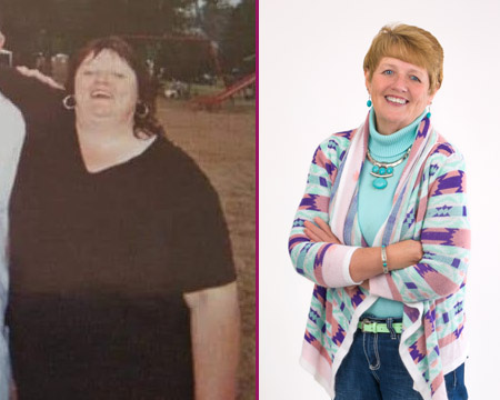 Kathy's Before and After Bariatric Surgery Photos
